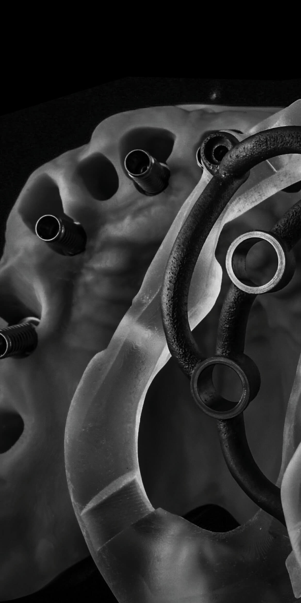 Full Arch for Technicians