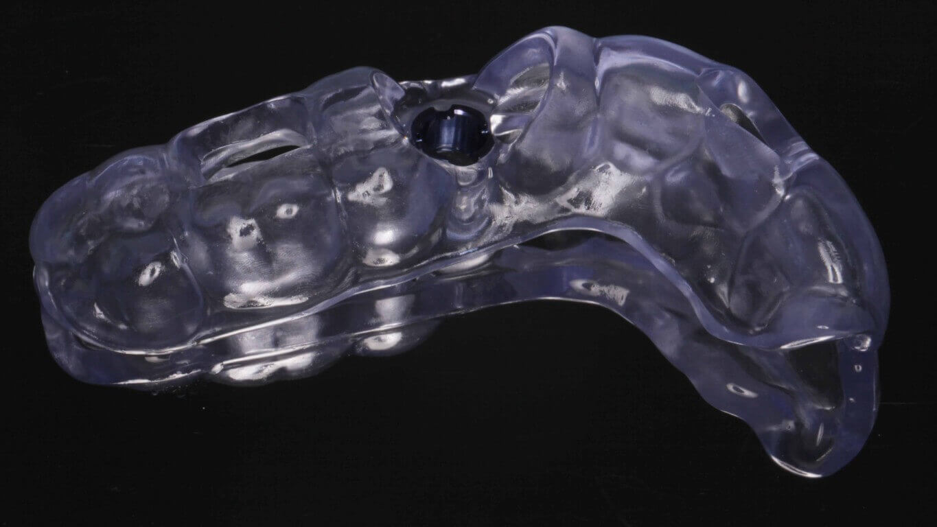 Additional media for Full Arch Surgery with Dr. Khartic Patel