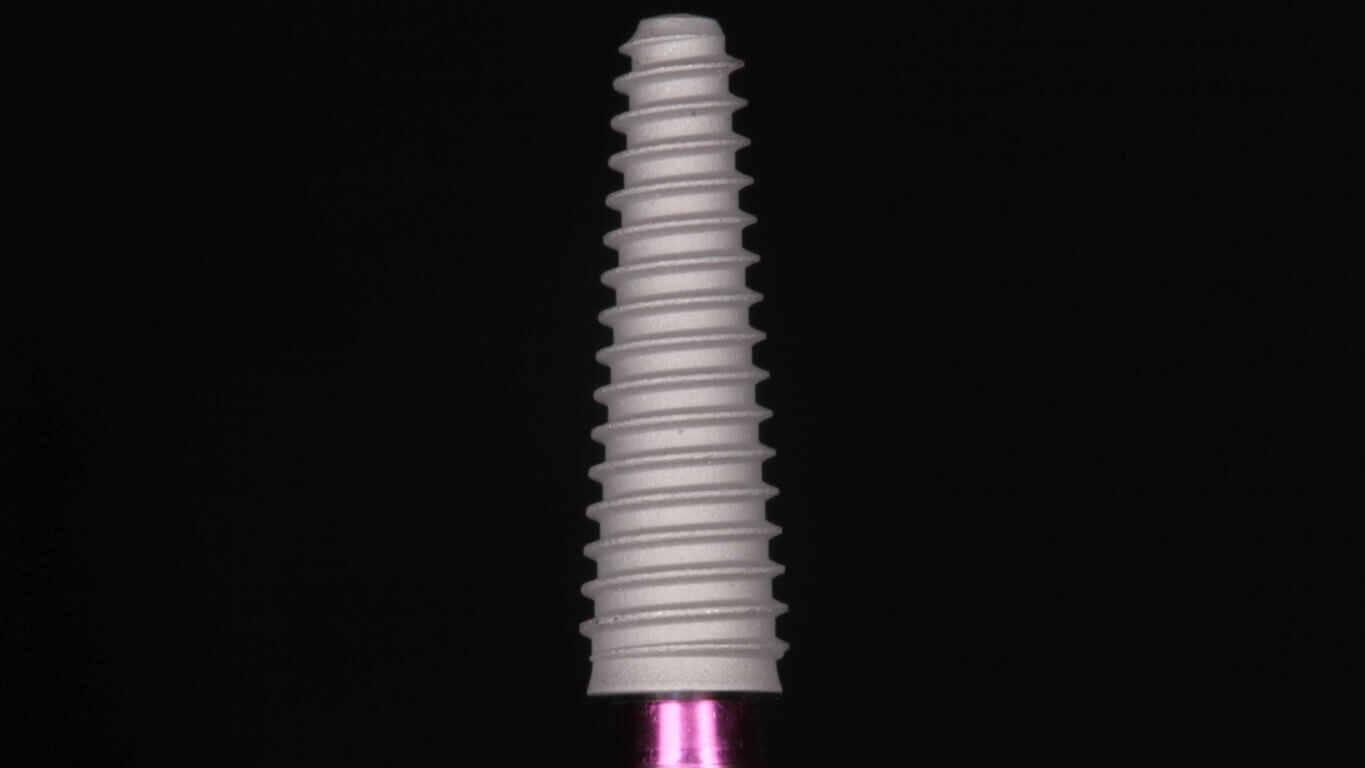 Gallery image for Full Arch Surgery with Dr. Khartic Patel