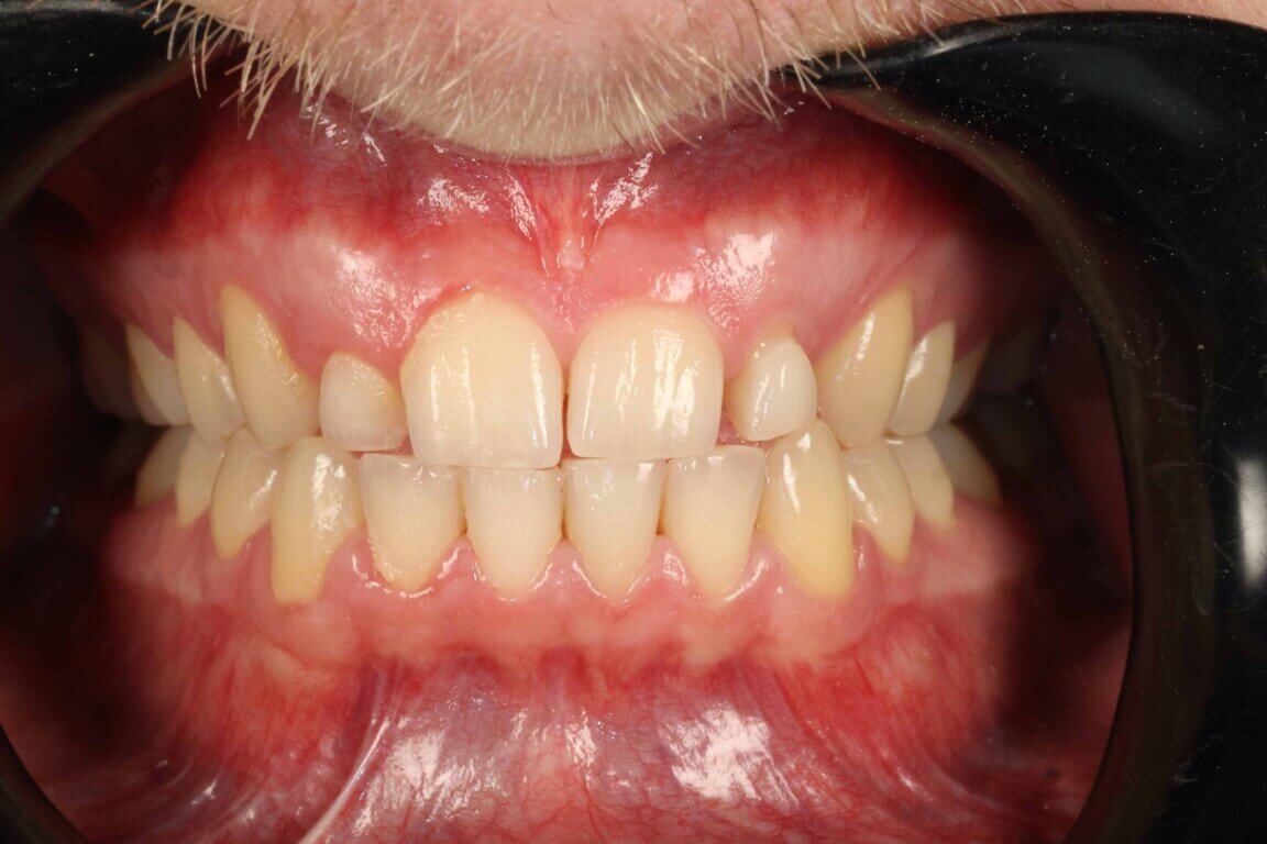 Additional media for Profilo Guided Surgery with Dr. Simon Chard