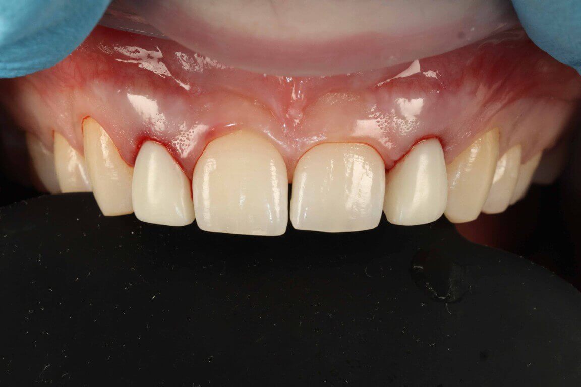 Gallery image for Profilo Guided Surgery with Dr. Simon Chard