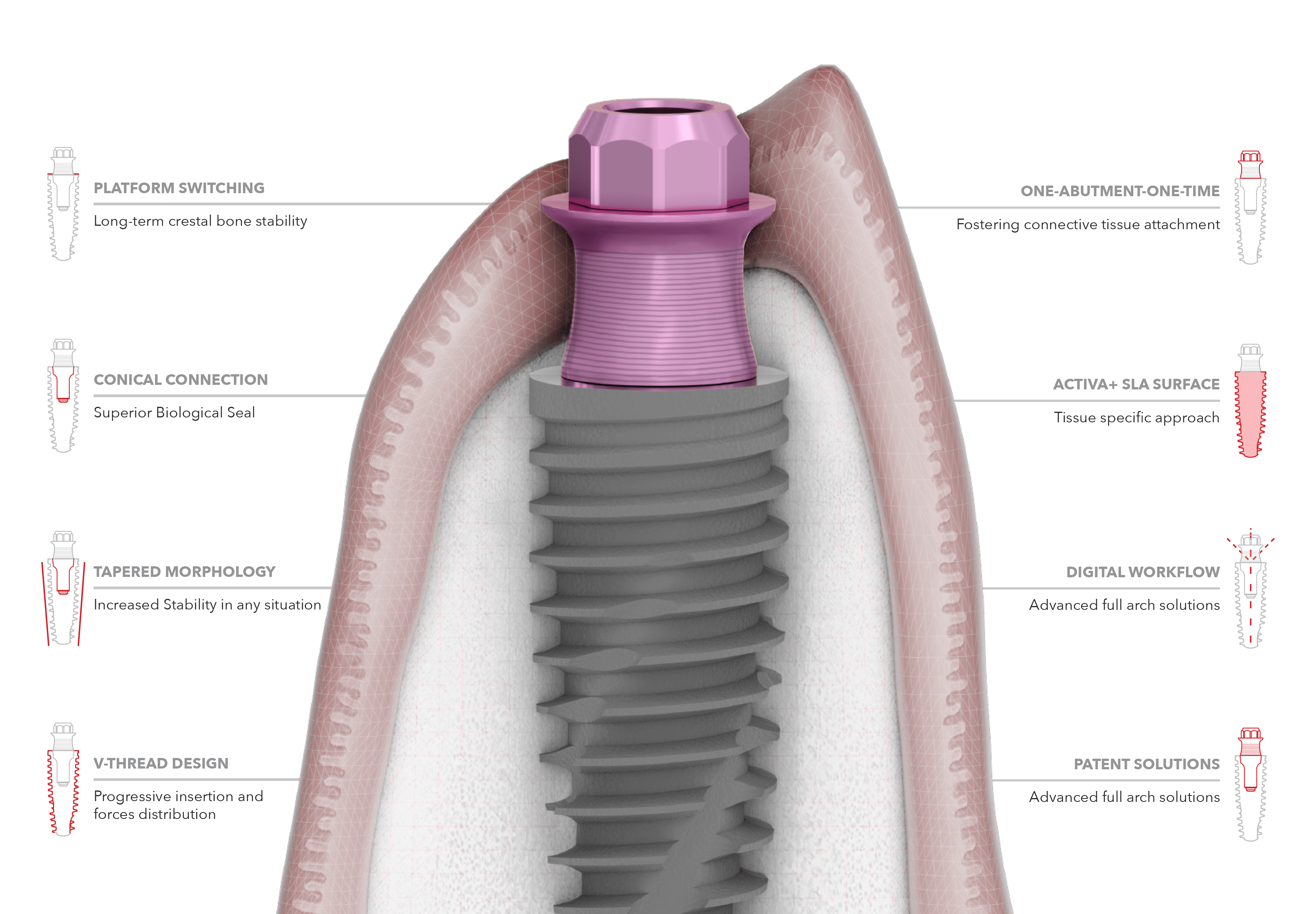 P-3 Implant