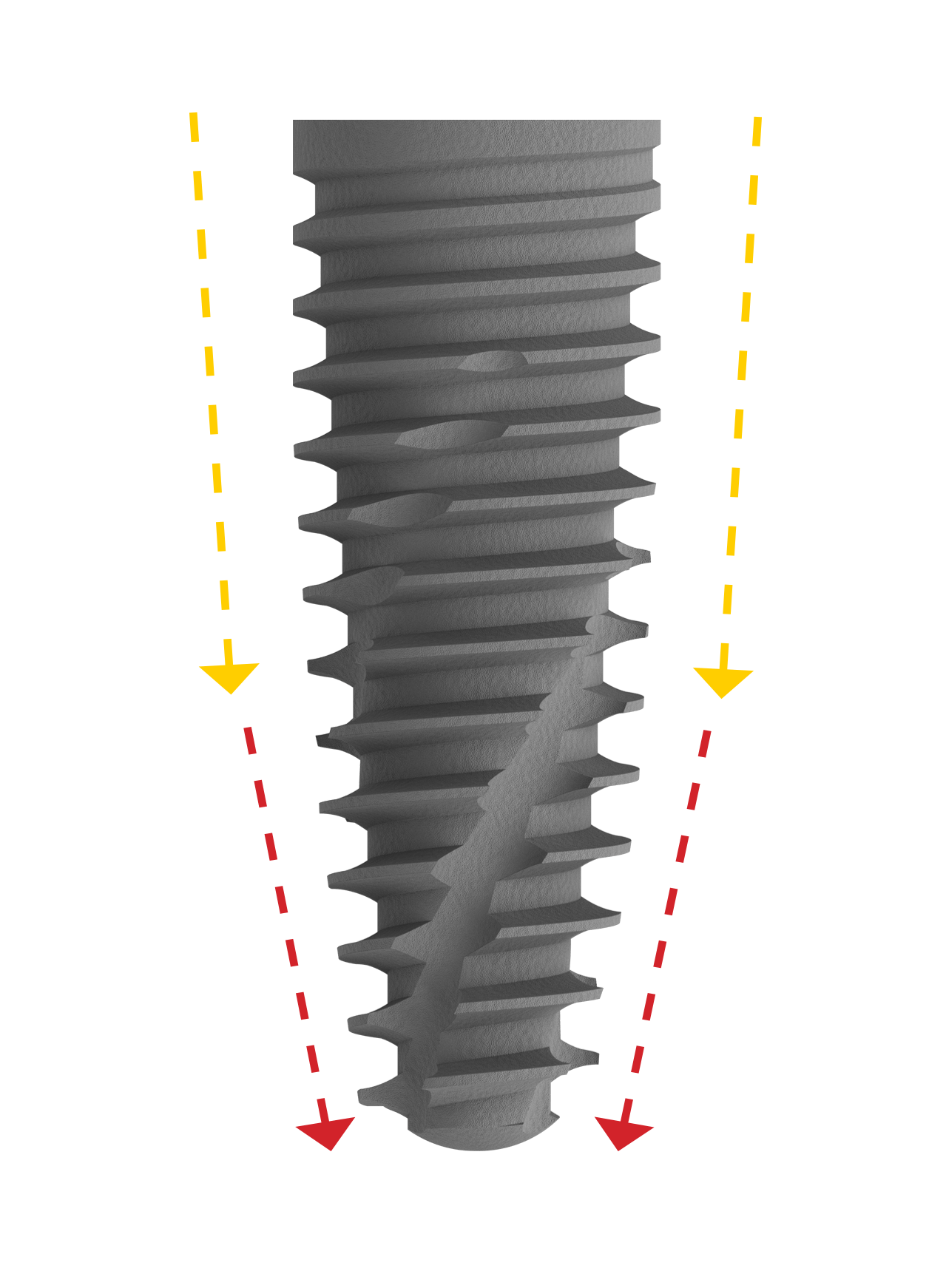 High Primary Stability.<br/>  Thanks to the P-3 Inserta’s unique tapered morphology and self-tapping design, <span class="text-primary-500">higher initial stability can be attained in any compromised bone situation</span> and post extractive sites